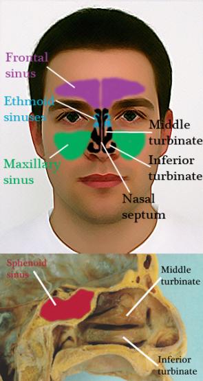 purulent nasal drainage